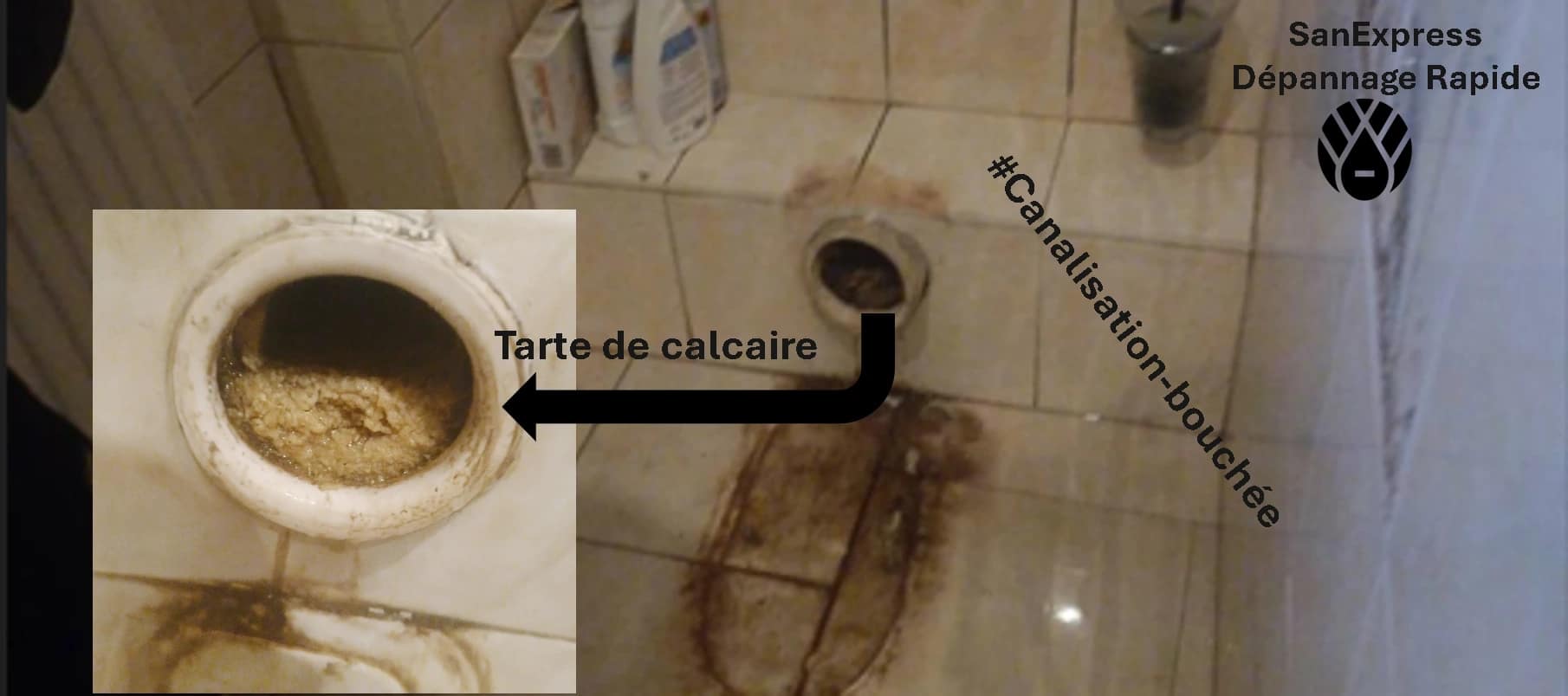 Montage visuel montrant une canalisation de WC fortement obstruée par un bouchon de tartre de calcaire. L’image inclut un zoom détaillé de l’intérieur du tuyau avec une flèche noire explicative “Tarte de calcaire”, le tout intégré dans une scène de salle de bain avec carreaux beiges. Hashtag #CanalisationBouchée et logo SanExpress en haut à droite